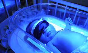 baby phototherapy